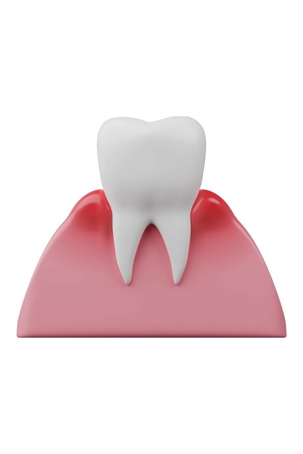 Painless Wisdom Tooth Extraction Mysore